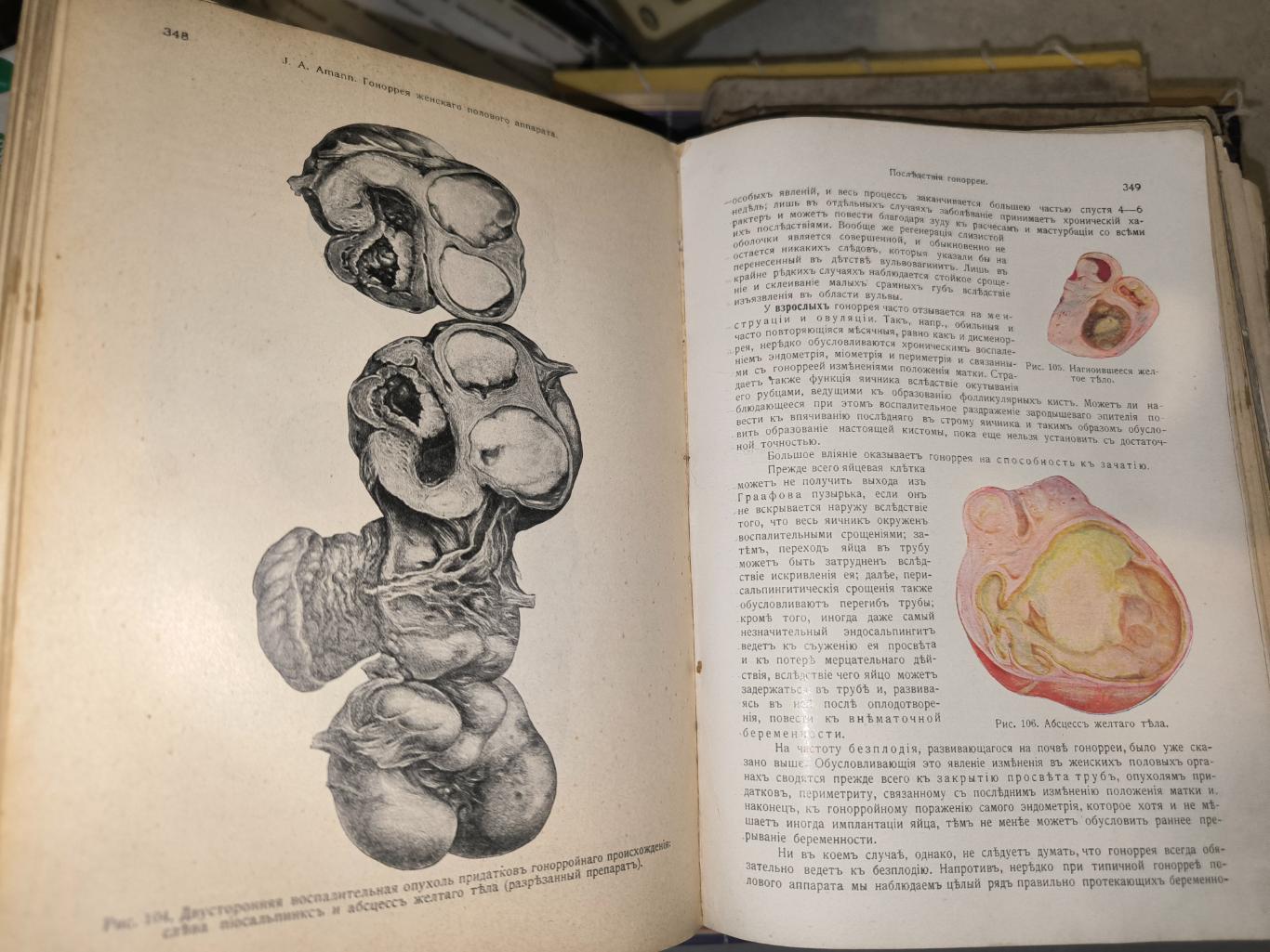 Менге Опитц Руководство по гинекологии 1914 6