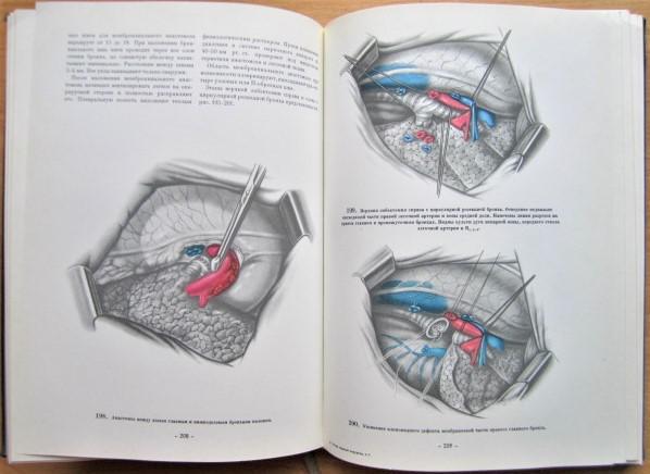 Атлас грудной хирургии. В двух томах. Том 1. 4
