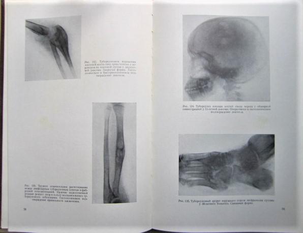 Рентгенодиагностика заболеваний костей и суставов. В двух книгах (комплект). 1