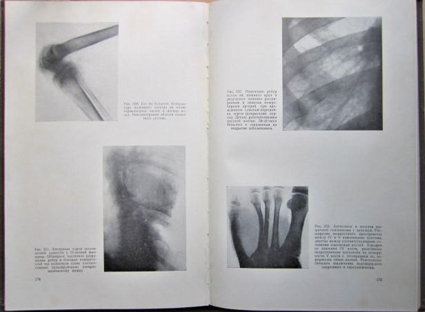 Рентгенодиагностика заболеваний костей и суставов. В двух книгах (комплект). 2