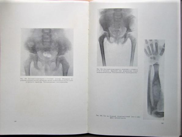 Рентгенодиагностика заболеваний костей и суставов. В двух книгах (комплект). 3