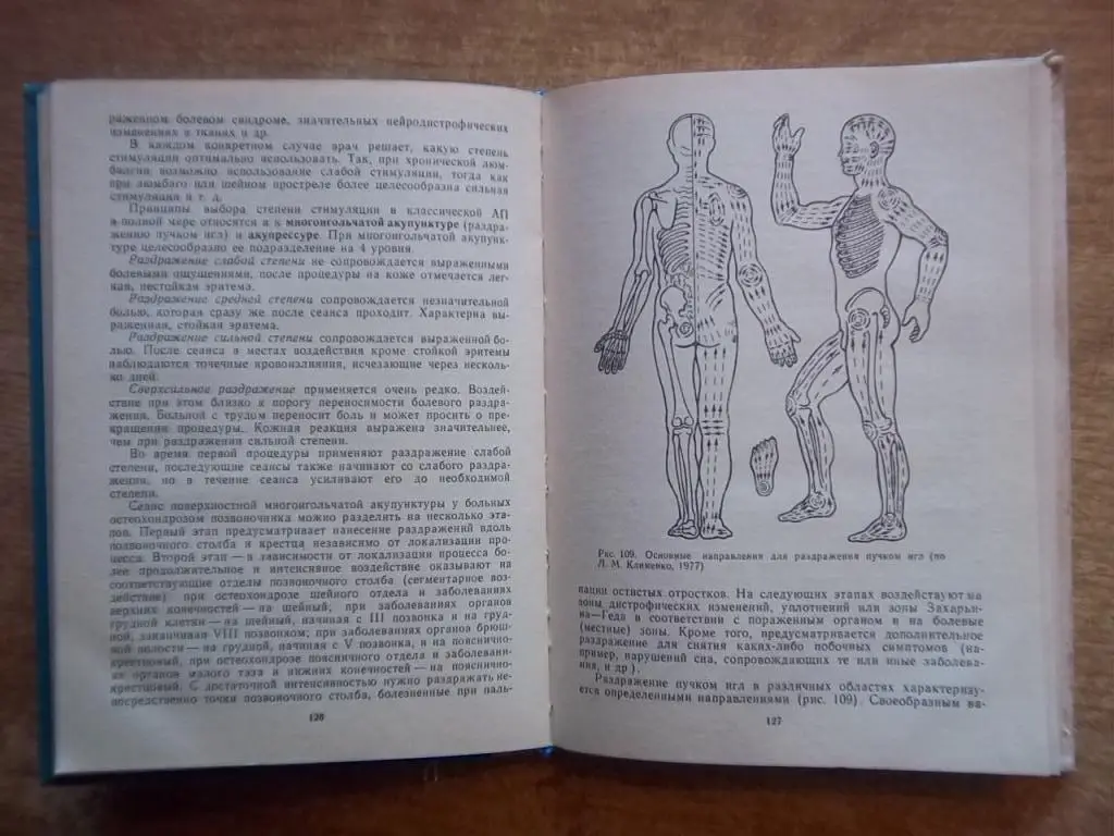 Мануальная, гомеопатическая и рефлексотерапия остеохондроза позвоночника. 4