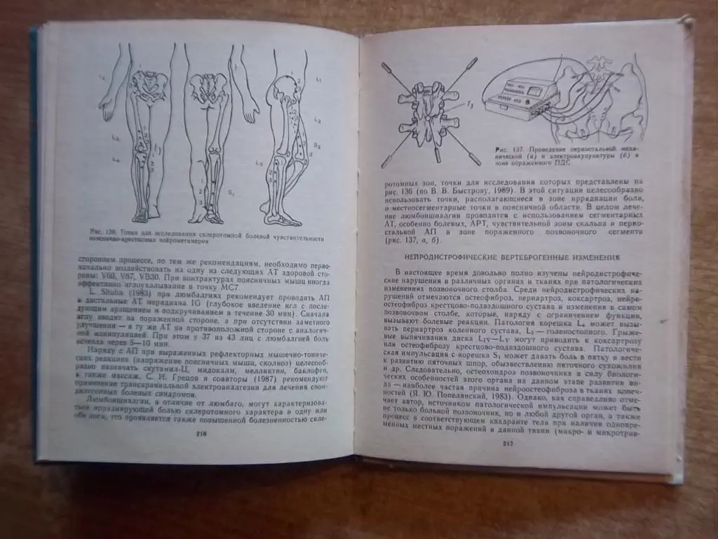 Мануальная, гомеопатическая и рефлексотерапия остеохондроза позвоночника. 1