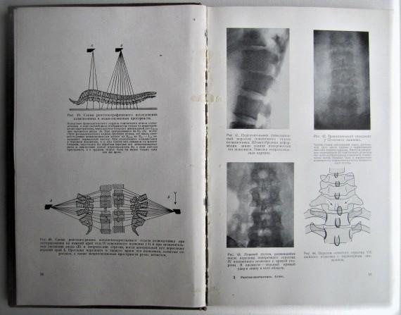 Рейнберг С.	Рентгенодиагностика заболеваний костей и суставов. В двух книгах. 5