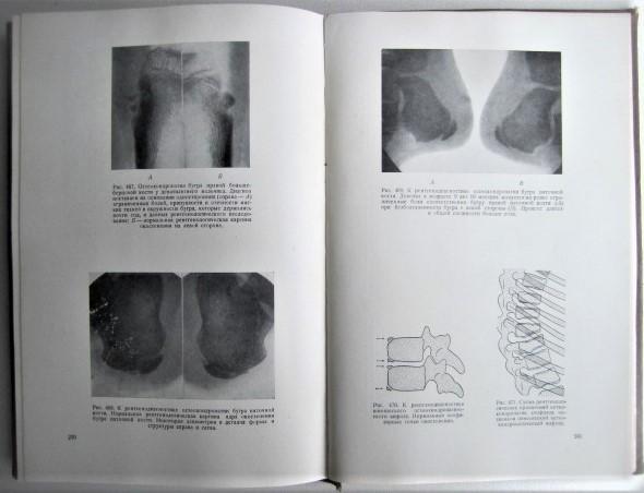 Рейнберг С.	Рентгенодиагностика заболеваний костей и суставов. В двух книгах. 6