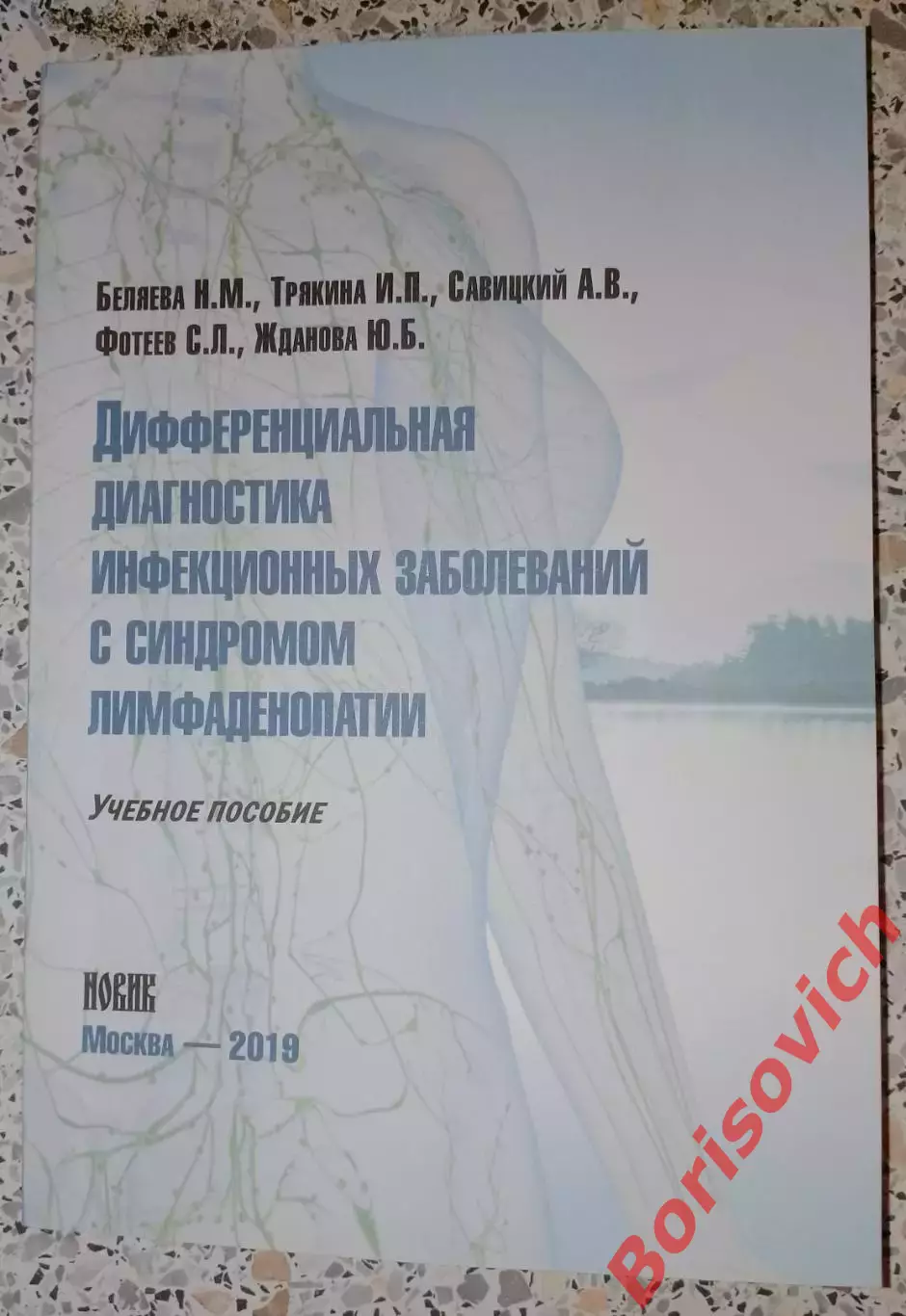 ДИФФЕРЕНЦИАЛЬНАЯ ДИАГНОСТИКА ИНФЕКЦИОННЫХ ЗАБОЛЕВАНИЙ С СИНДРОМОМ ЛИМФАДЕНОПАТИИ