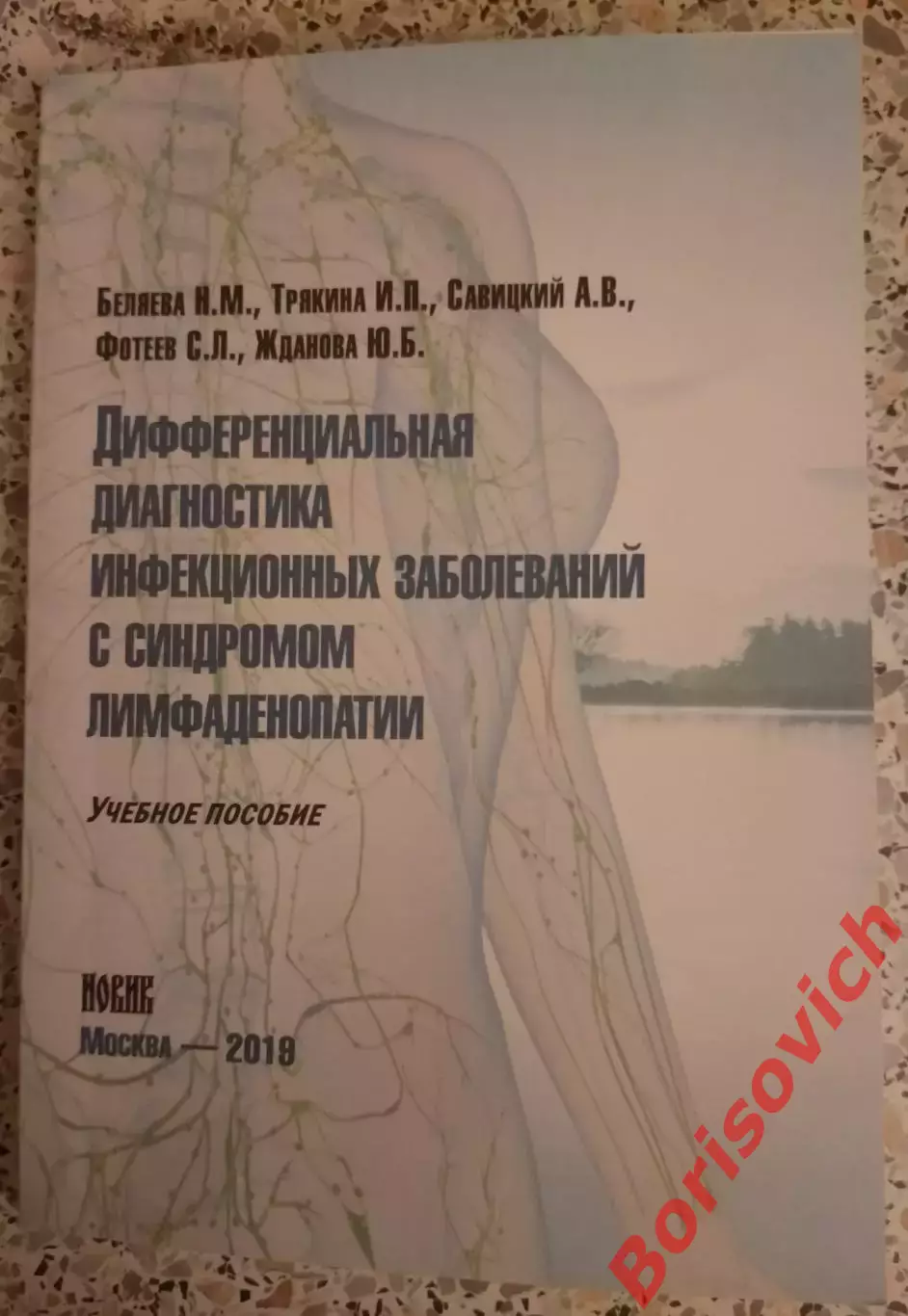 ДИФФЕРЕНЦИАЛЬНАЯ ДИАГНОСТИКА ИНФЕКЦИОННЫХ ЗАБОЛЕВАНИЙ С СИНДРОМОМ ЛИМФАДЕНОПАТИИ