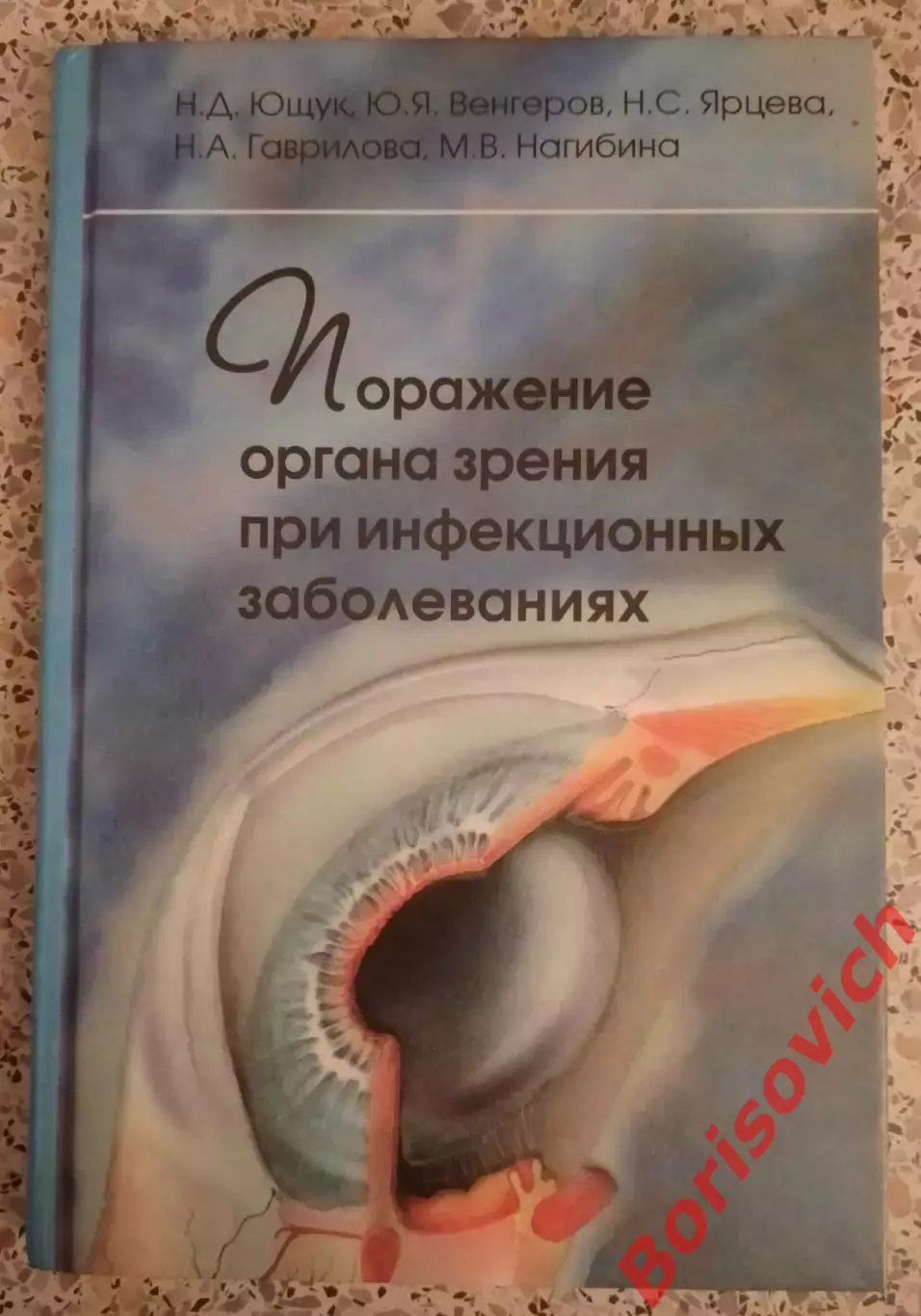 ПОРАЖЕНИЕ ОРГАНОВ ЗРЕНИЯ ПРИ ИНФЕКЦИОННЫХ ЗАБОЛЕВАНИЯХ 2006 г 176 с Тираж 1500