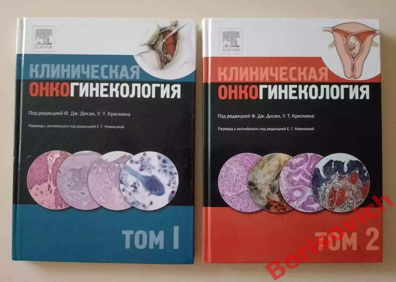 КЛИНИЧЕСКАЯ ОНКОГИНЕКОЛОГИЯ 2011 г 2 тома 316 и 324 стр Тираж 2000 и 1500 экз