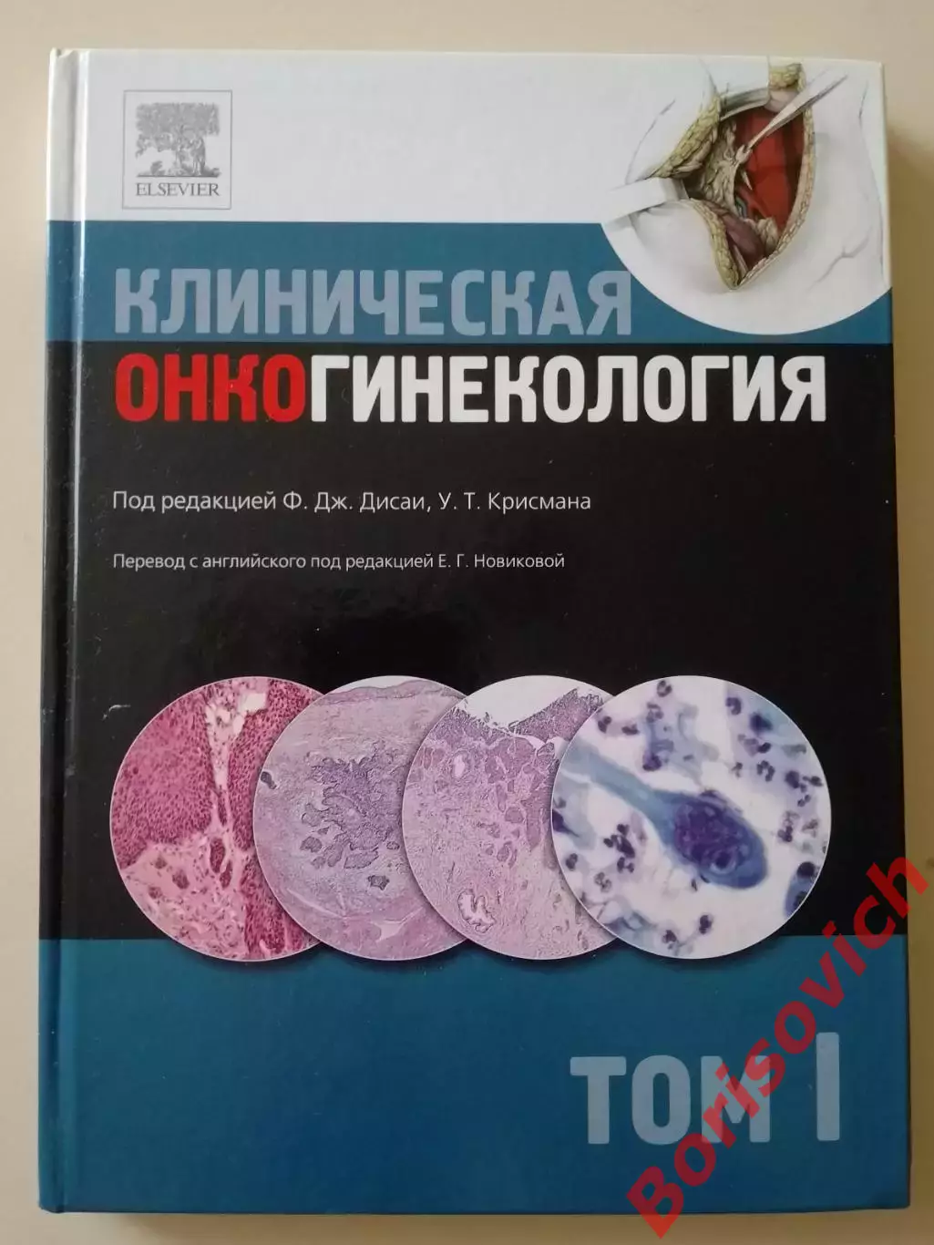 КЛИНИЧЕСКАЯ ОНКОГИНЕКОЛОГИЯ 2011 г 2 тома 316 и 324 стр Тираж 2000 и 1500 экз 1