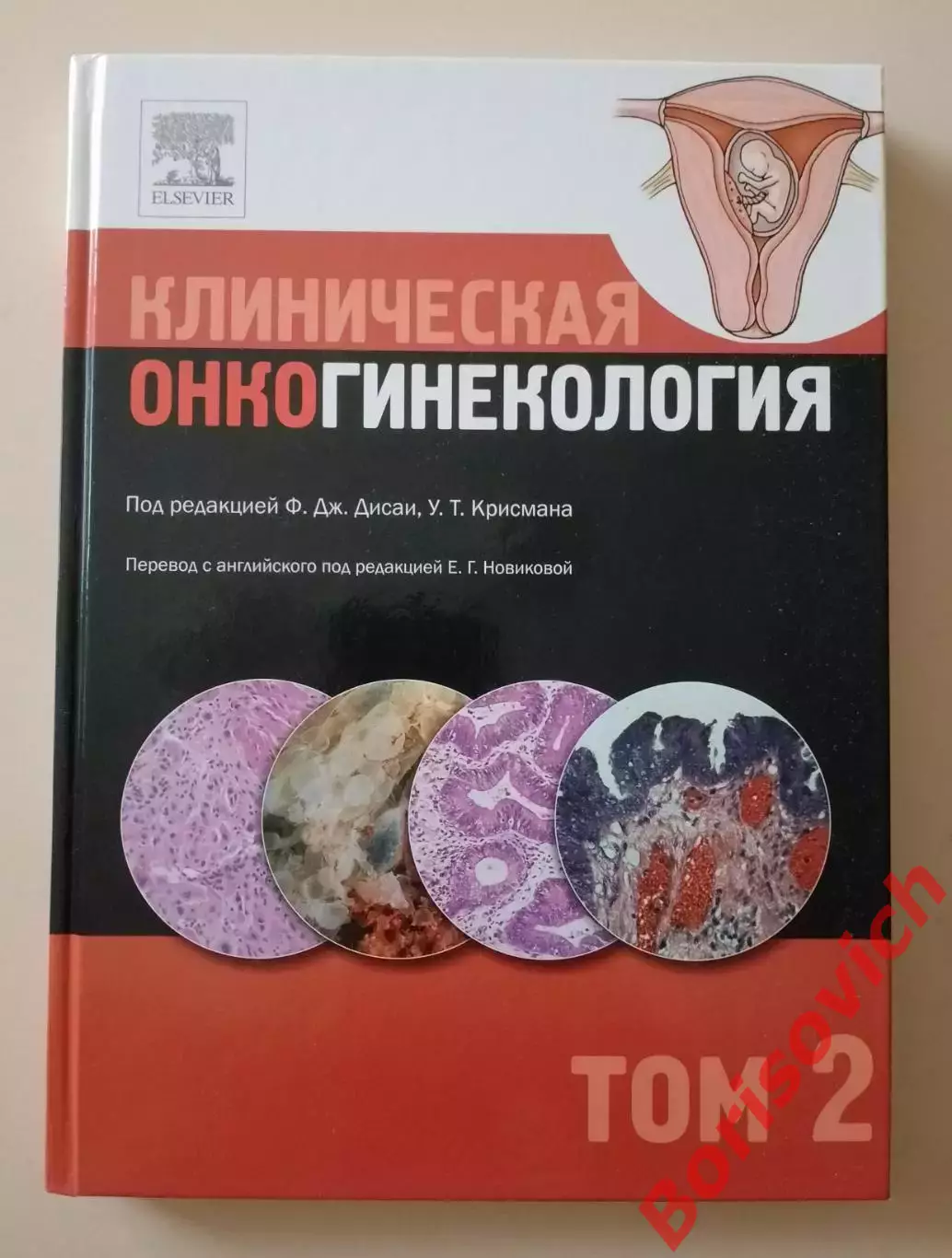 КЛИНИЧЕСКАЯ ОНКОГИНЕКОЛОГИЯ 2011 г 2 тома 316 и 324 стр Тираж 2000 и 1500 экз 3