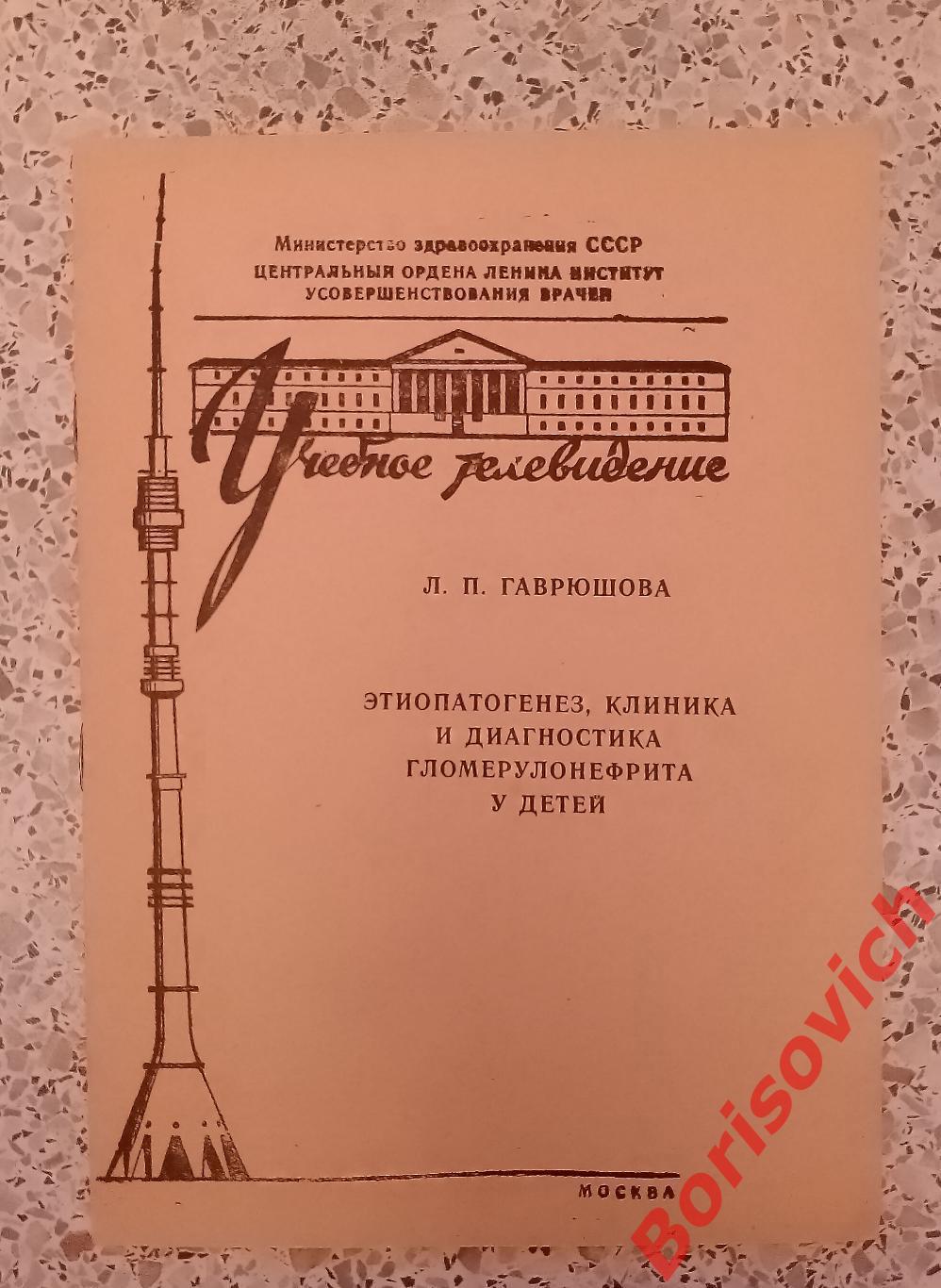 Этиопатогинез, клиника и диагностика гломерулонефрита у детей 1976 г Тираж 2000