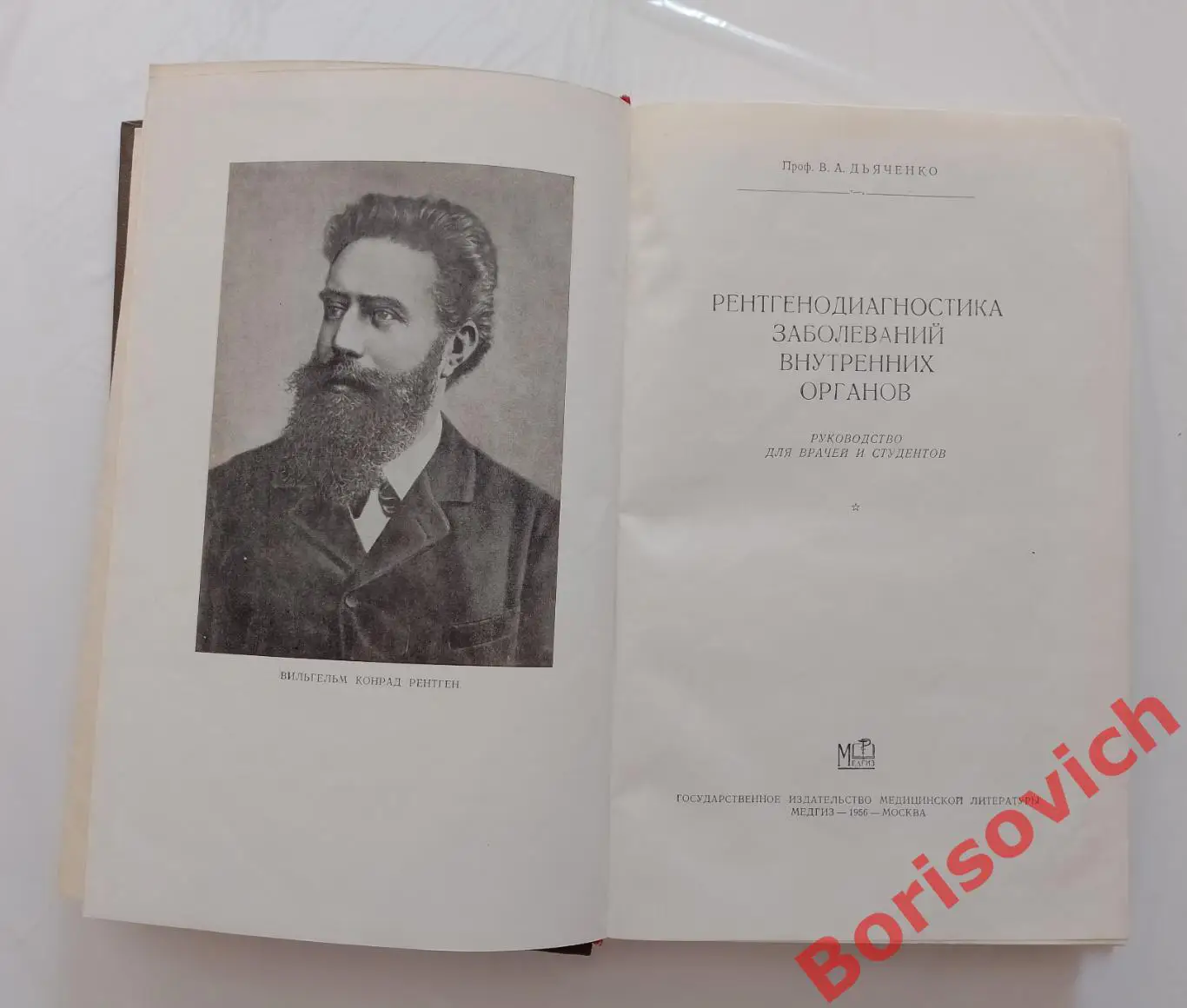 РЕНТГЕНОДИАГНОСТИКА ЗАБОЛЕВАНИЙ ВНУТРЕННИХ ОРГАНОВ 1956 г 335 стр Тираж 25 000 1