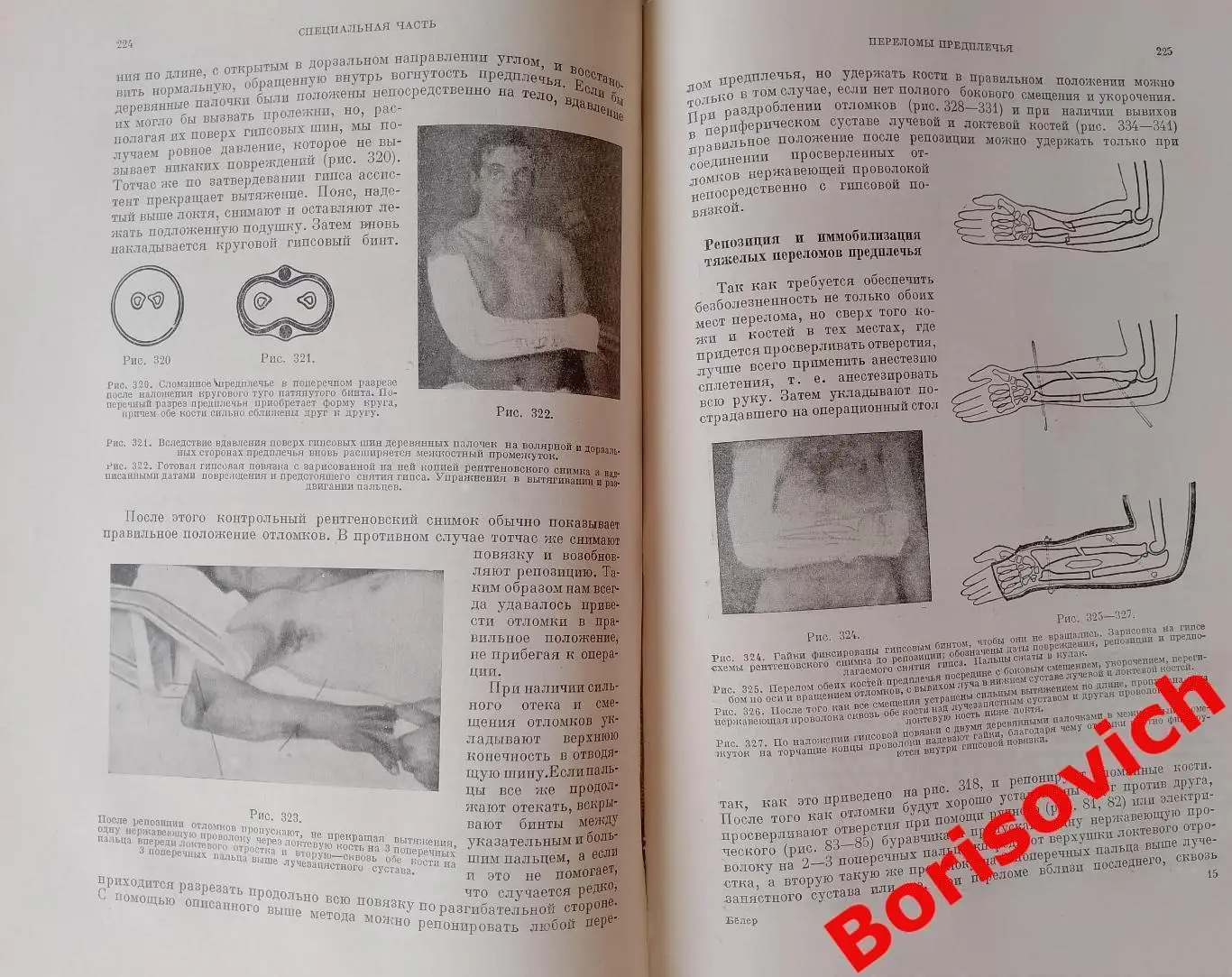 Л. Белер ТЕХНИКА ЛЕЧЕНИЯ ПЕРЕЛОМОВ КОСТЕЙ 1937 г 502 стр Тираж 10 200 экз 6