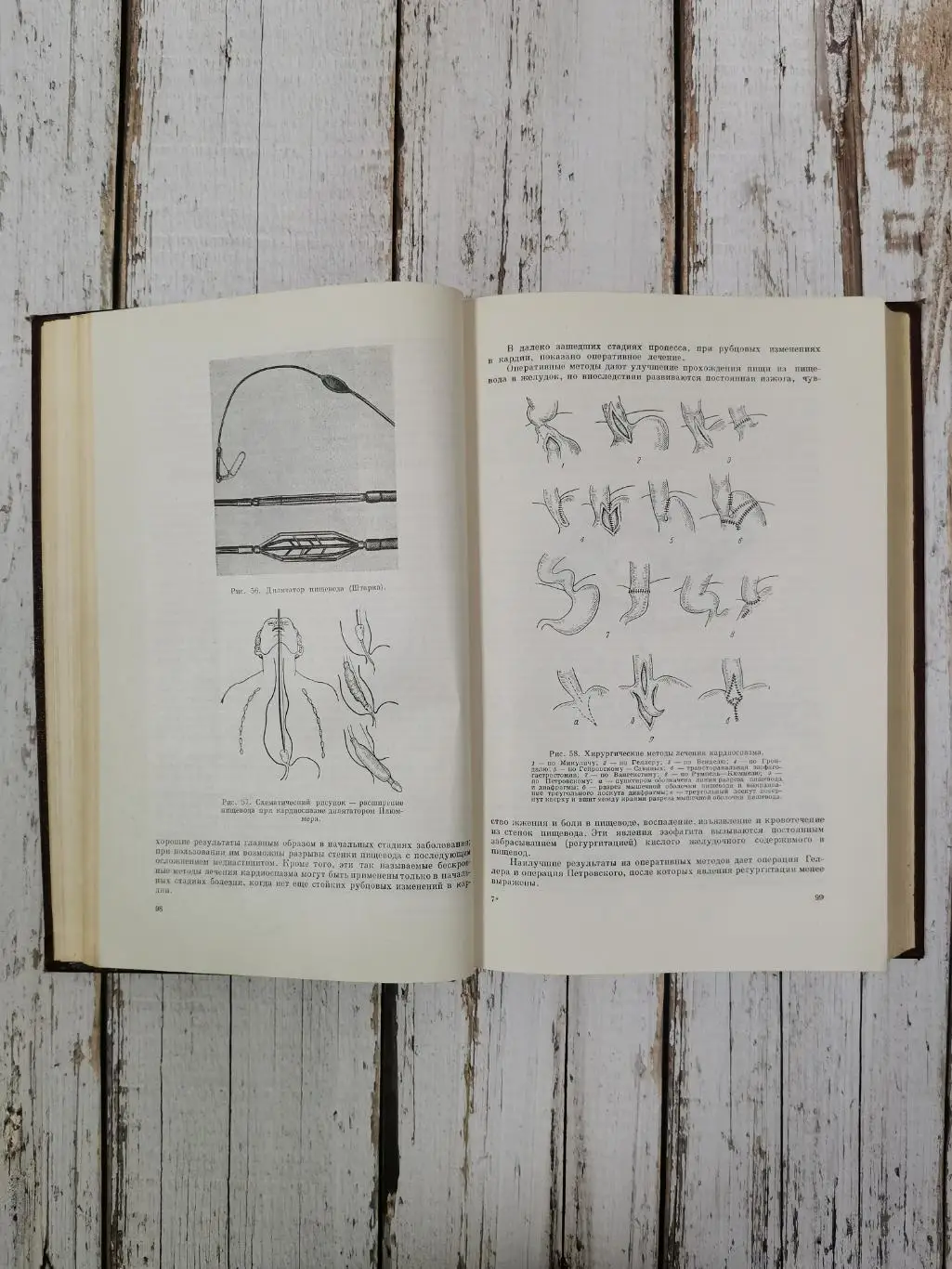 Еланский Н.Н. Хирургические болезни, 650 стр., 1964 г. Медицина СССР 4