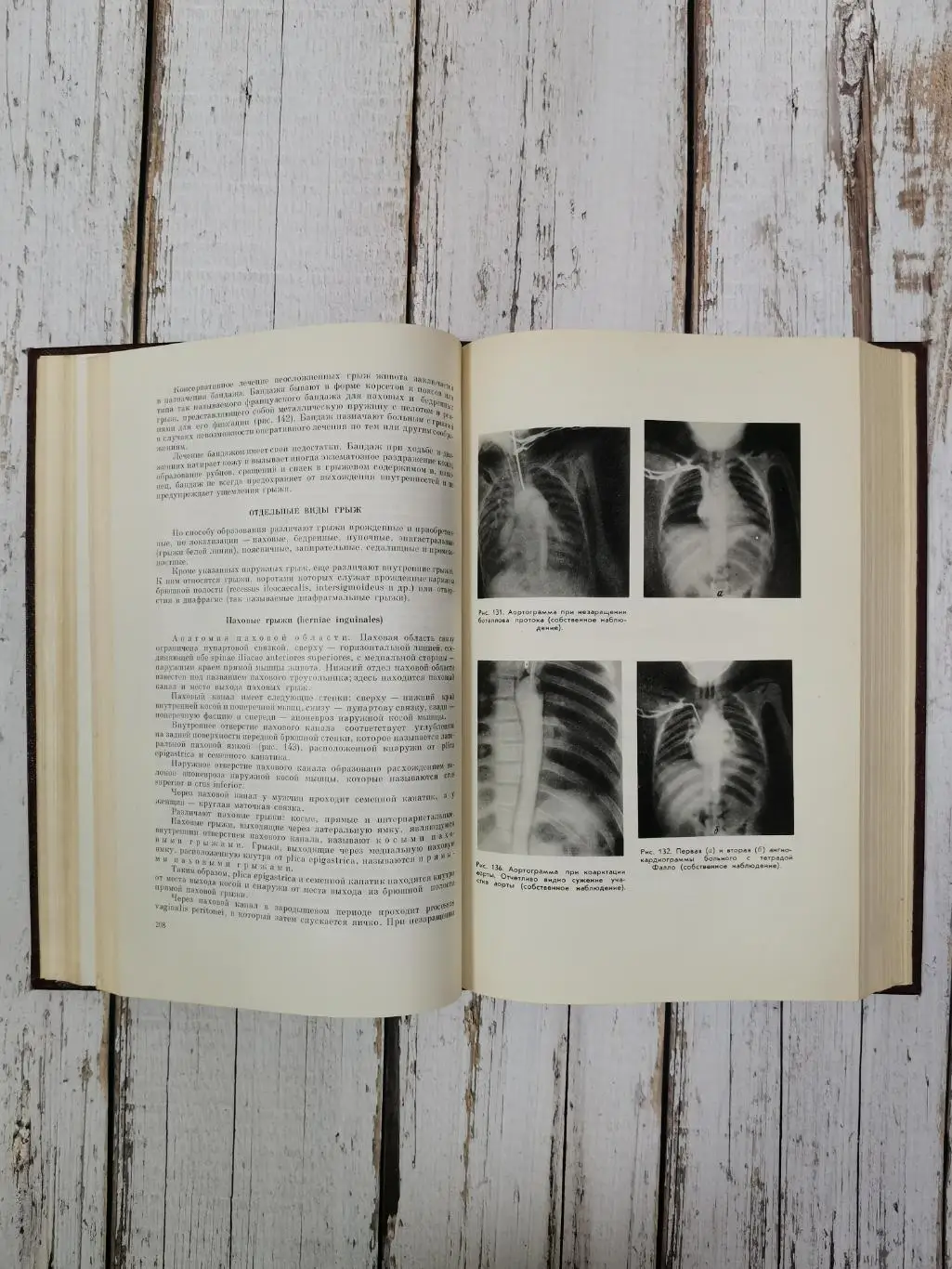 Еланский Н.Н. Хирургические болезни, 650 стр., 1964 г. Медицина СССР 5