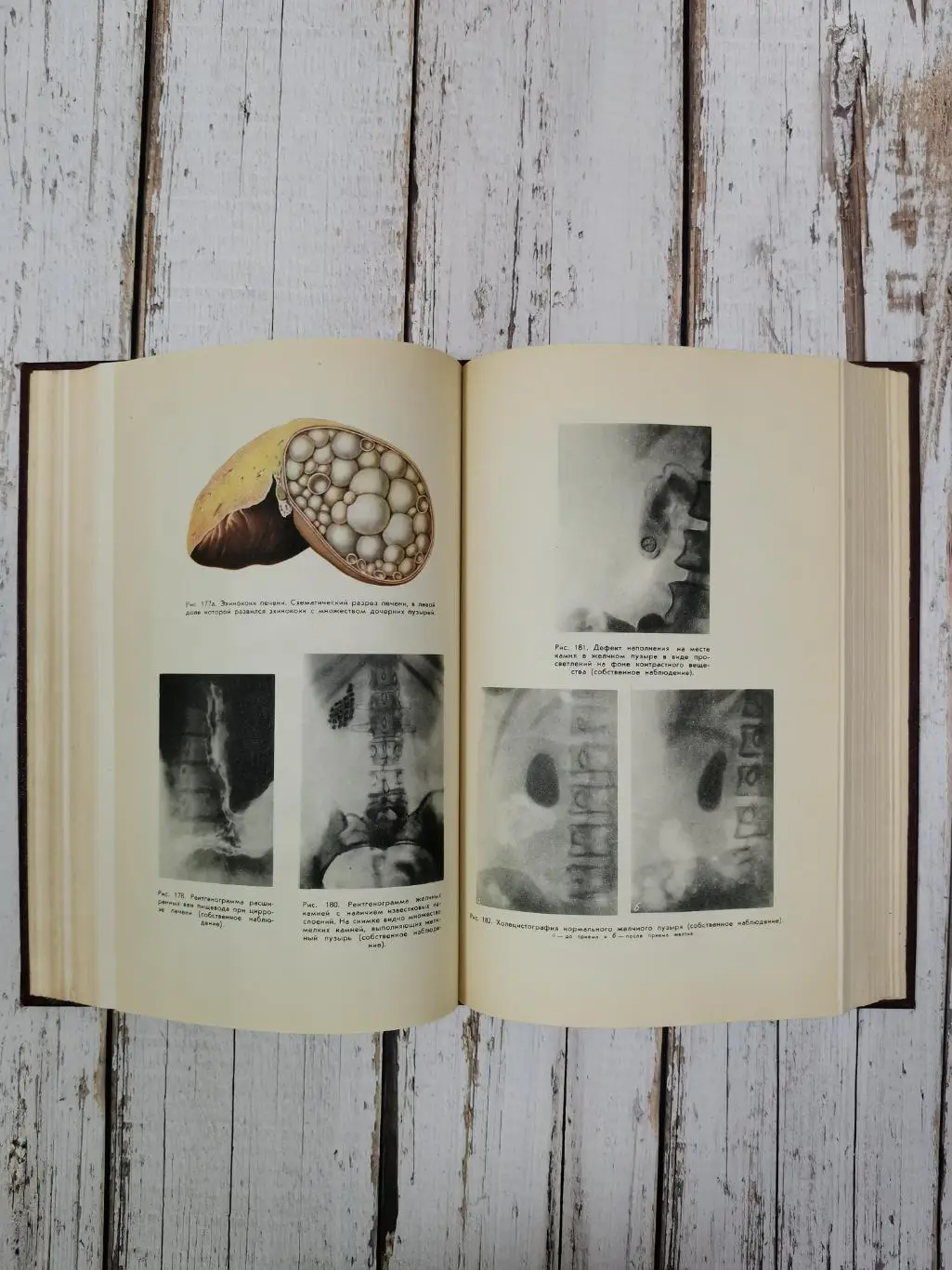 Еланский Н.Н. Хирургические болезни, 650 стр., 1964 г. Медицина СССР 6