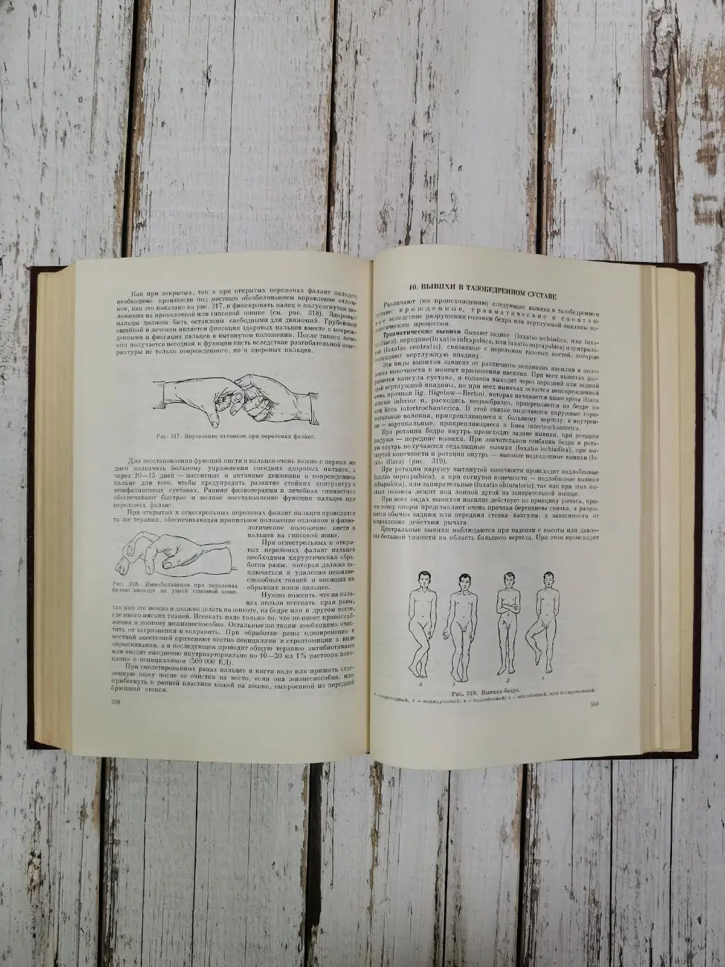 Еланский Н.Н. Хирургические болезни, 650 стр., 1964 г. Медицина СССР 7