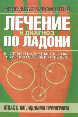 Лечение и диагноз по ладони. Атлас с наглядными примерами