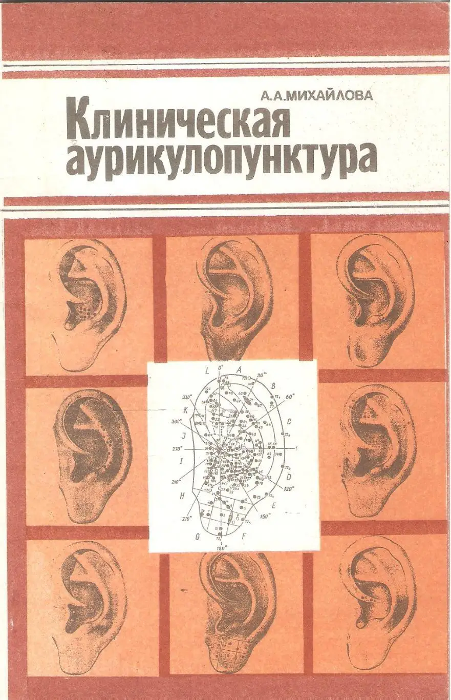 Клиническая аурикулопунктура