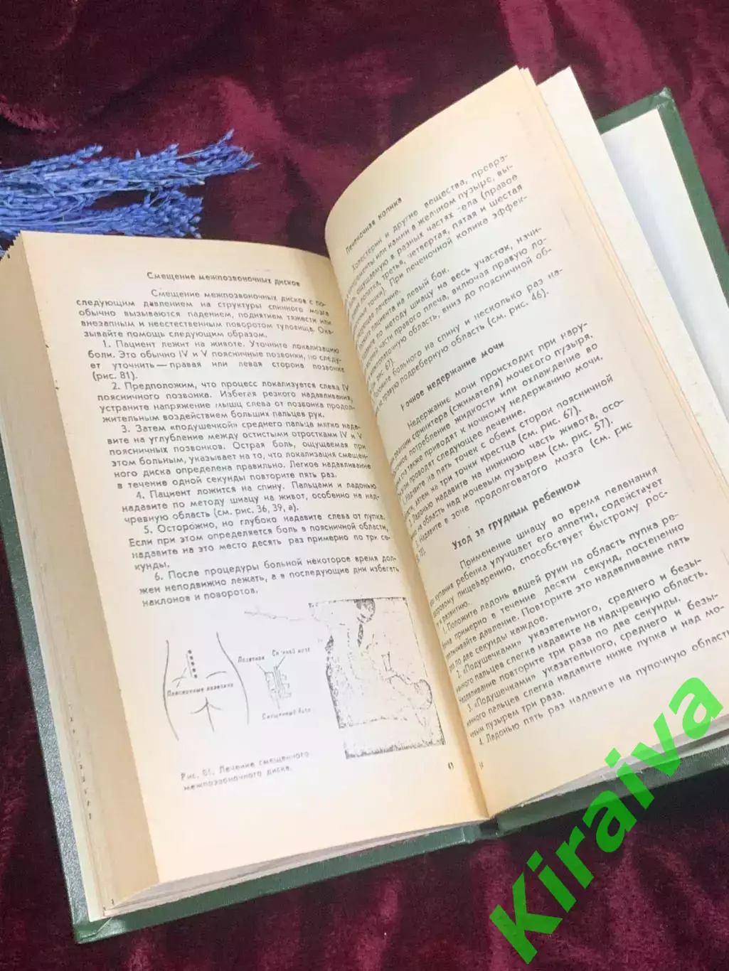 Книга «Шиацу: Японская терапия нажатием пальцами», О Намикоши, 1986 год, Н2506 4