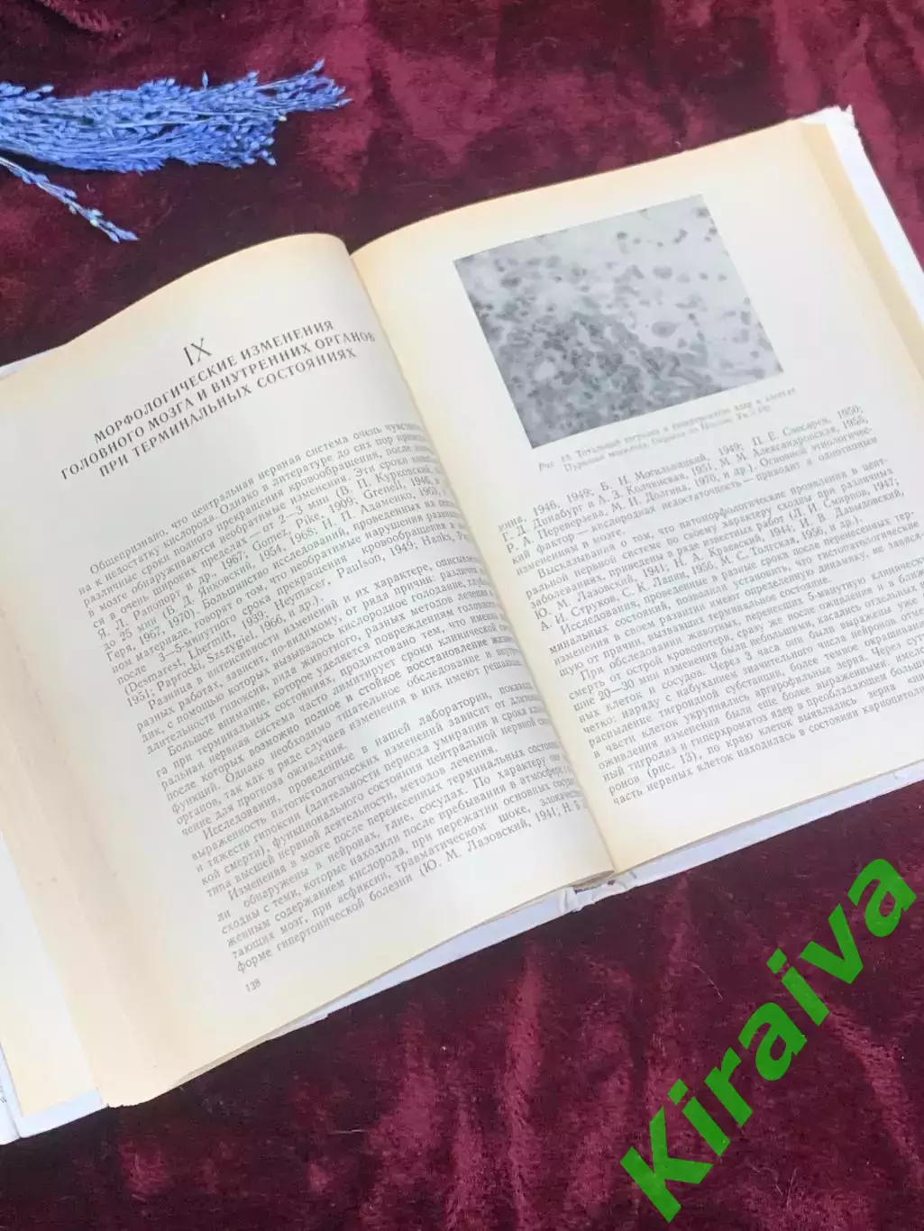 Книга по медицине «Основы реаниматологии» В. А. Неговского, 1975 г., Н2512 5