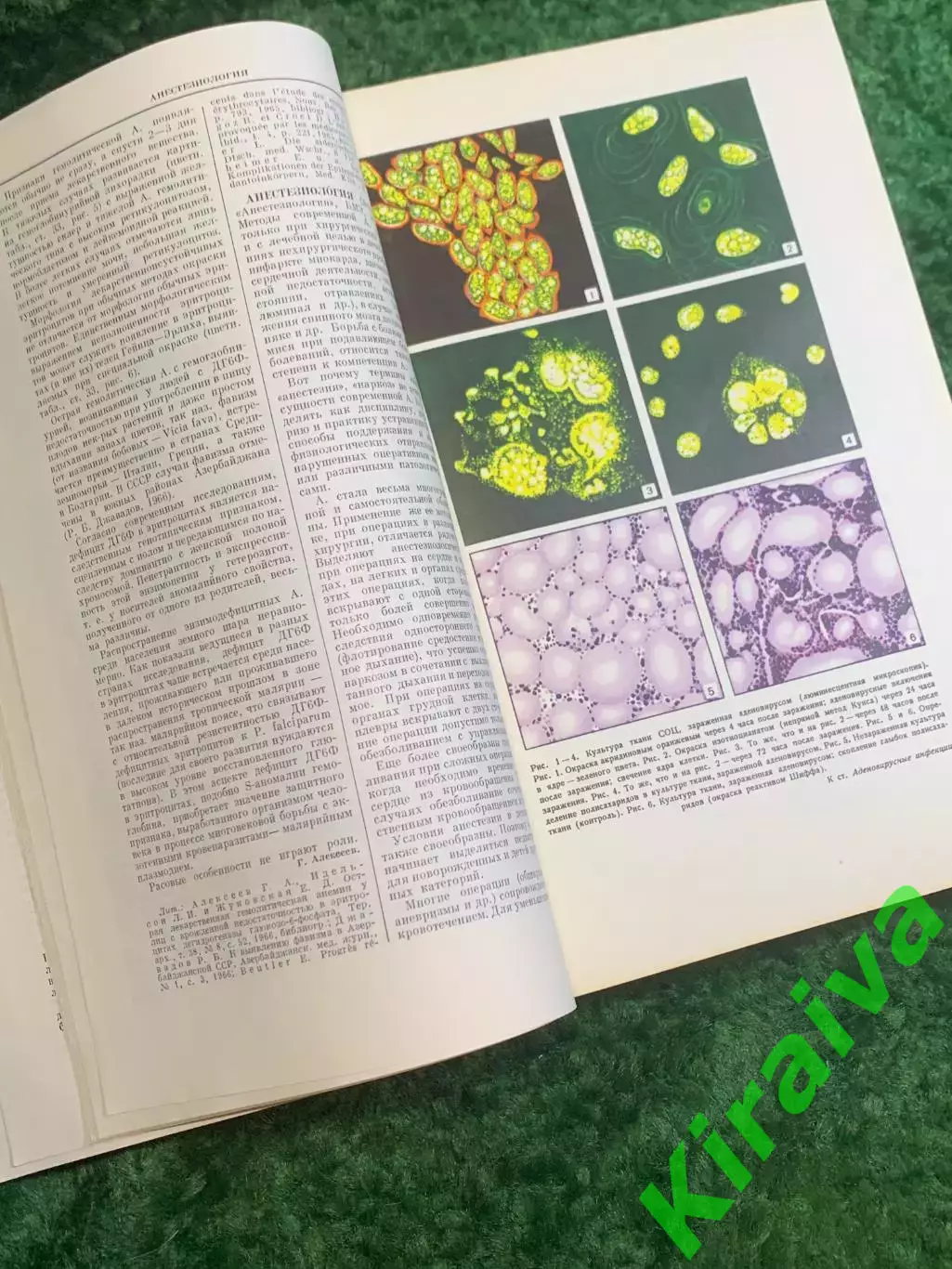 Книга медицинский справочник «Ежегодник Большой медицинской энциклопедии» Н2830 4