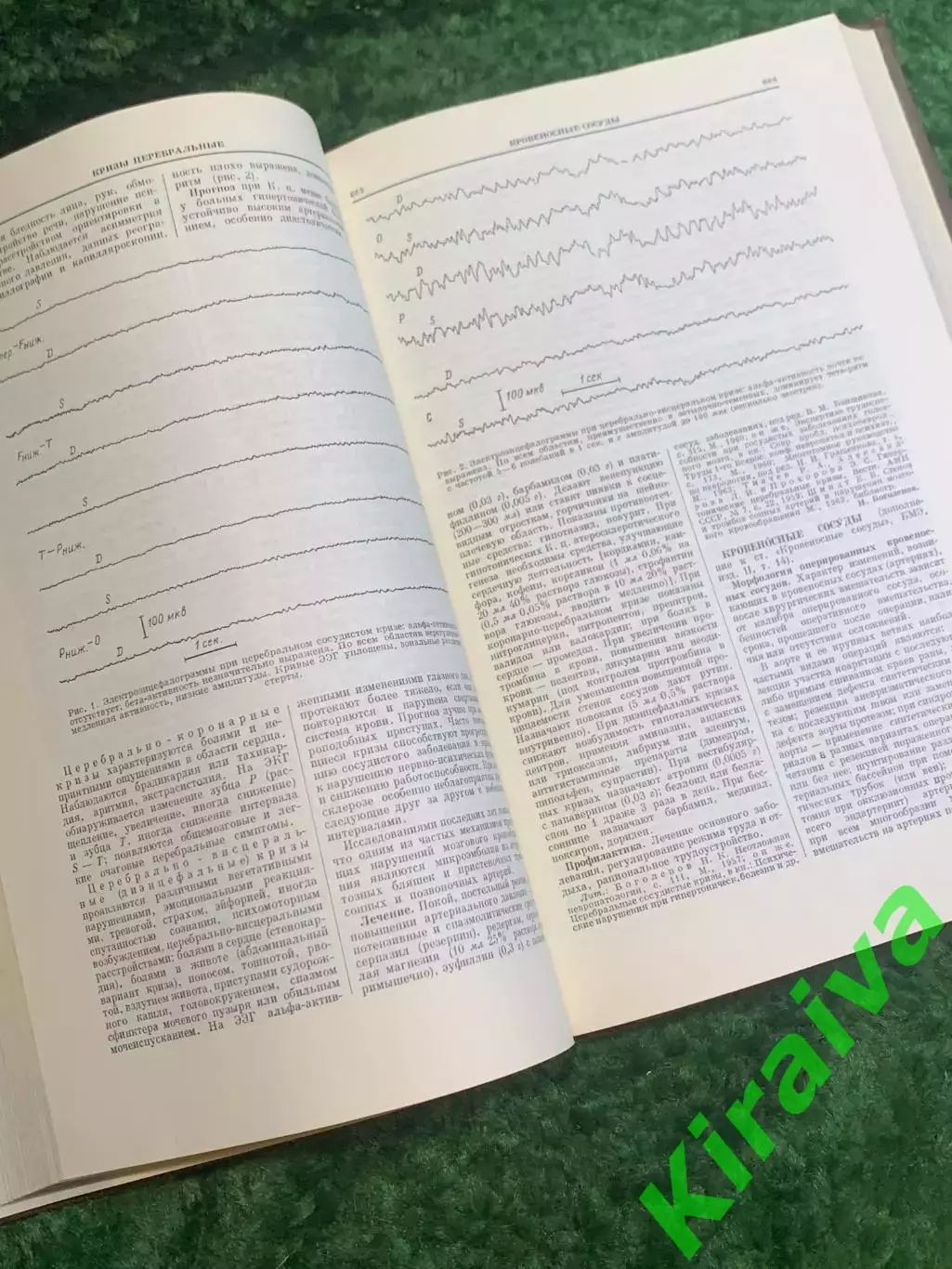 Книга медицинский справочник «Ежегодник Большой медицинской энциклопедии» Н2830 5