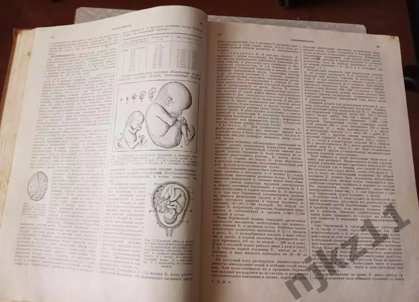 ПОПУЛЯРНАЯ МЕДИЦИНСКАЯ ЭНЦИКЛОПЕДИЯ, 1963 г. 2