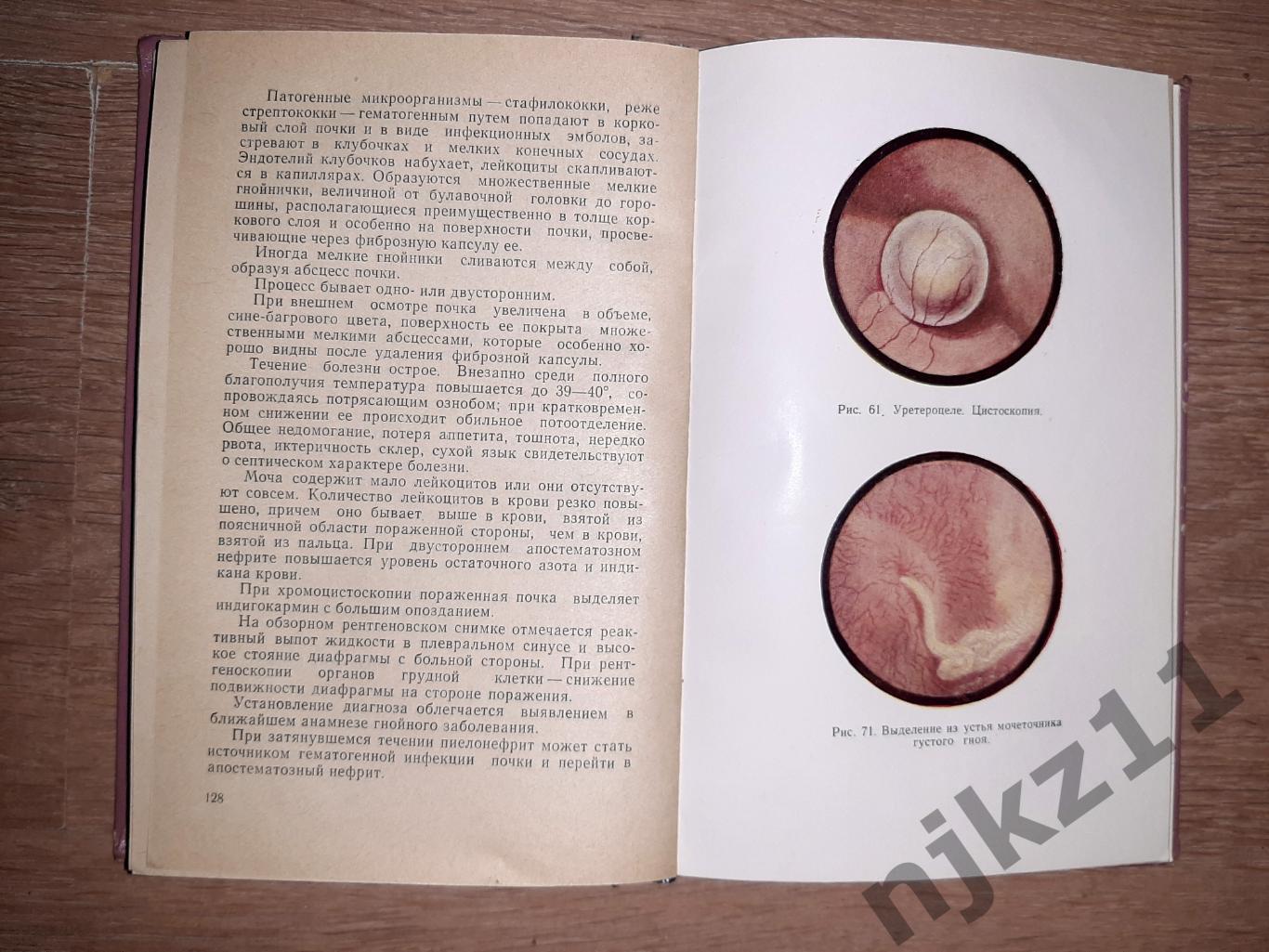 УРОЛОГИЯ Медицина Москва Книга 1966 год. СССР И.М.Эпштейн. ВРАЧАМ УРОЛОГАМ! 2