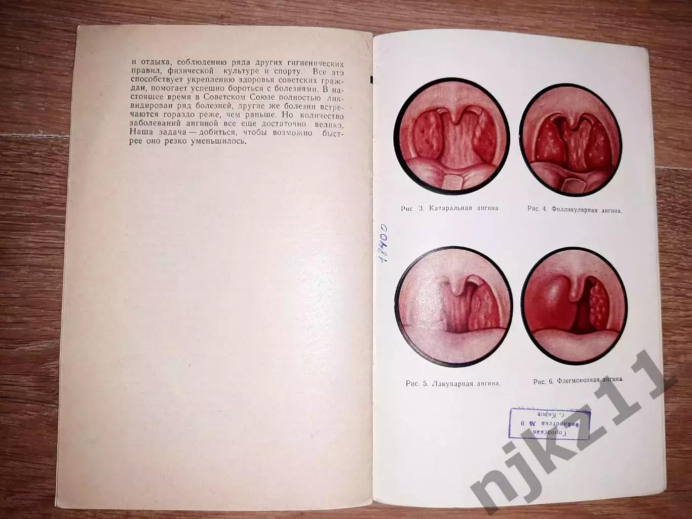 книга Преображенский Предупреждение ангины 1965г 3