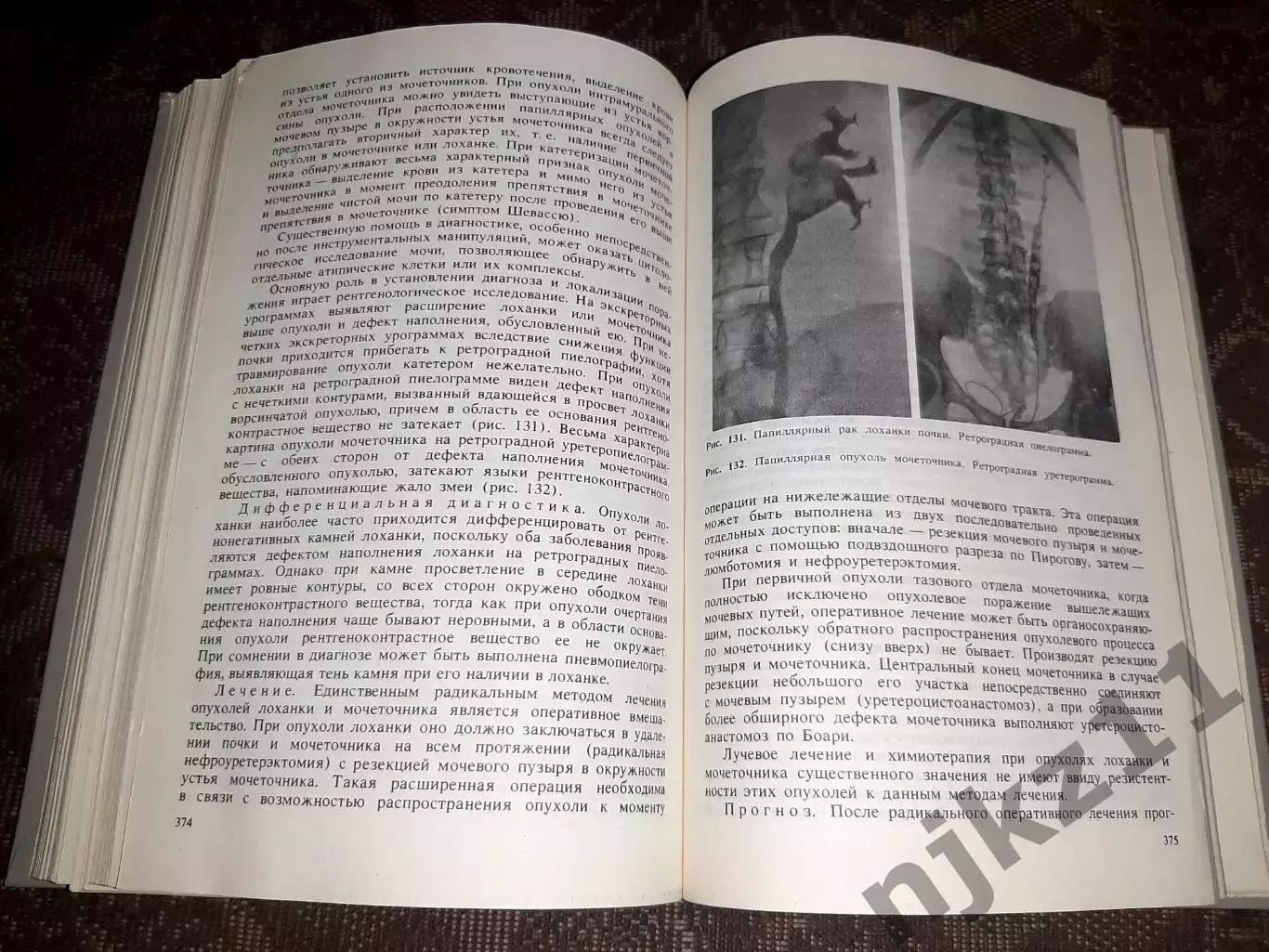 Урология Н.А.Лопаткин 1992 отличное состояние 4