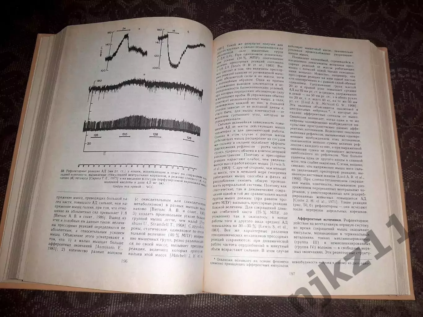 Чазов, Е.И. Болезни сердца и сосудов том 1 3