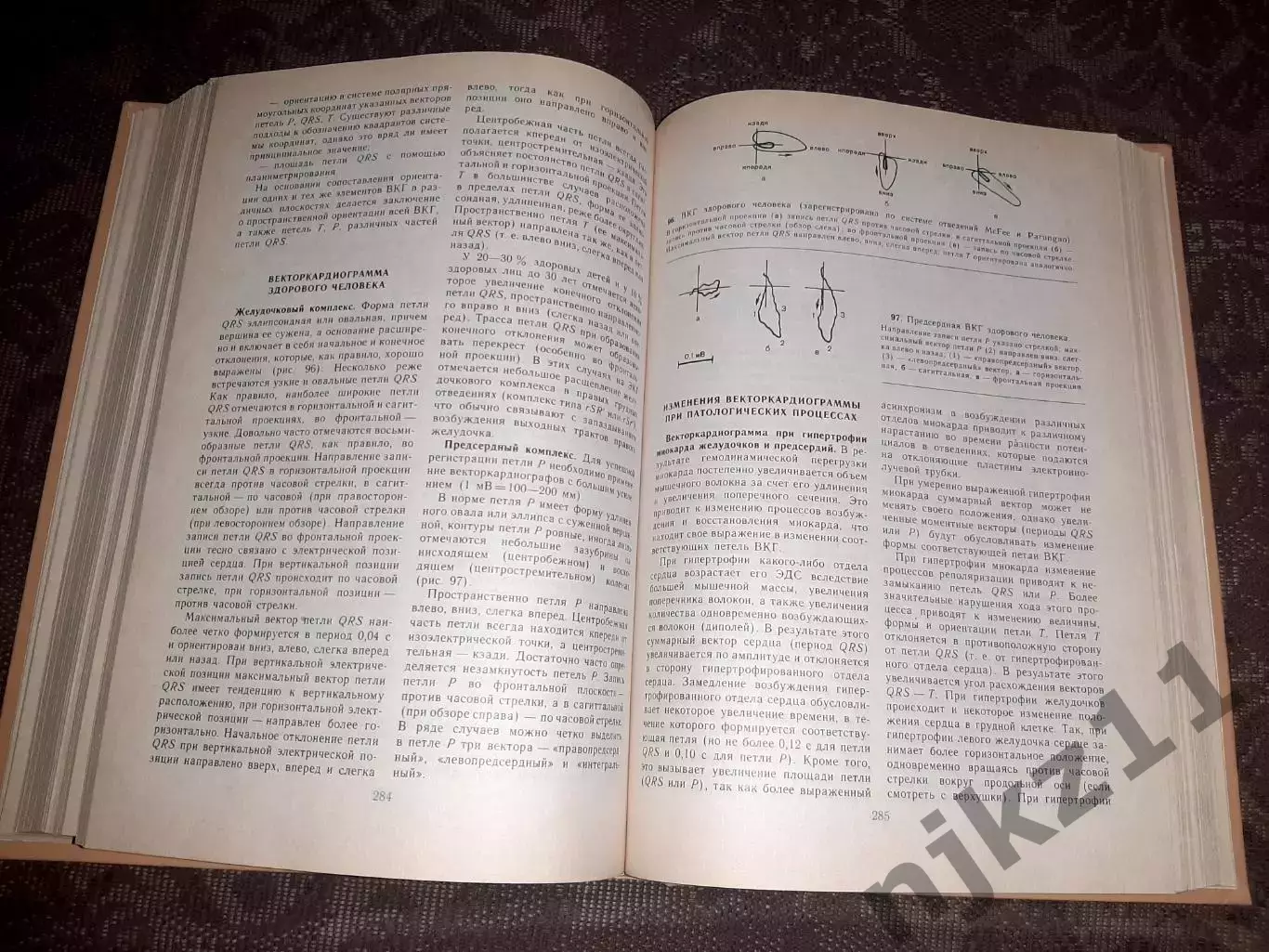 Чазов, Е.И. Болезни сердца и сосудов том 1 4