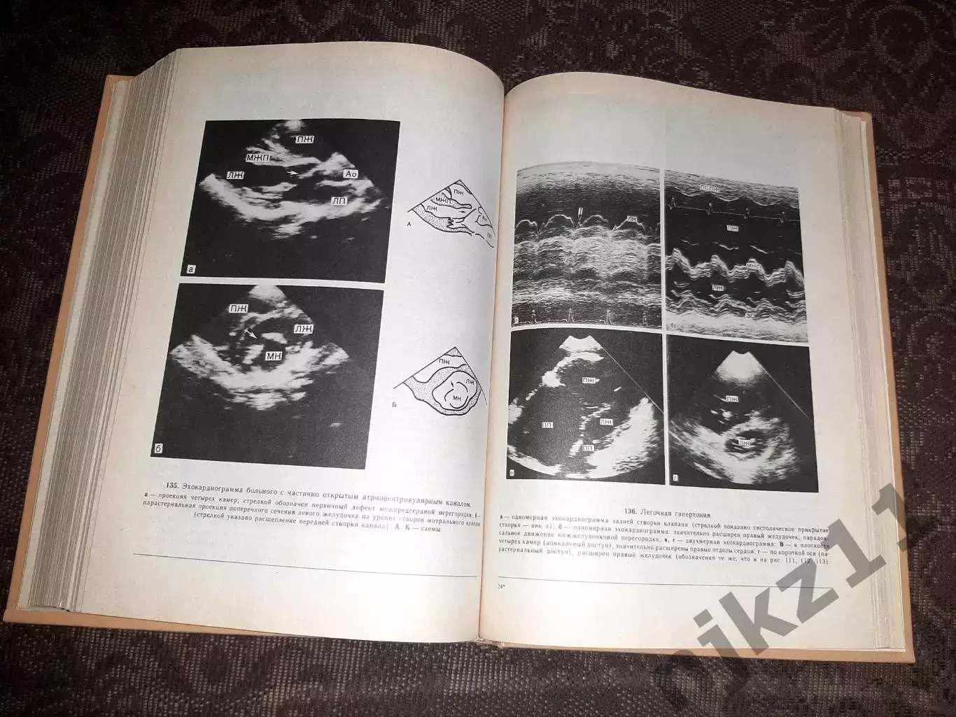 Чазов, Е.И. Болезни сердца и сосудов том 1 5