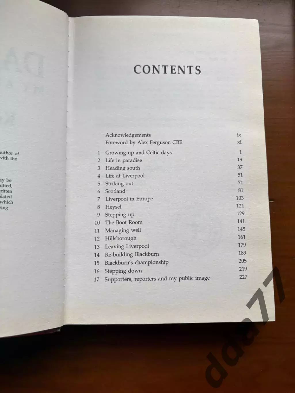 (К13) Книга автобіографія Кенні Далгліша «Dalglish: My Autobiography» (1996) 2