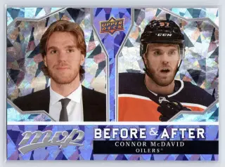 2021-22 Upper Deck MVP Before and After #BA2 Connor McDavid