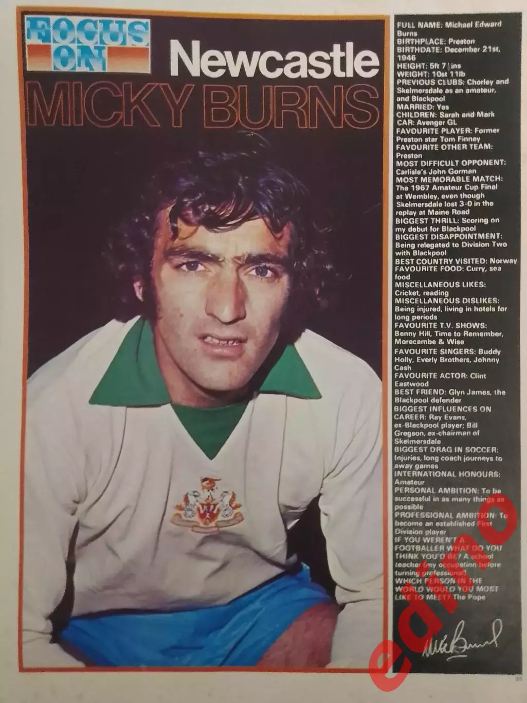 Micky Burns