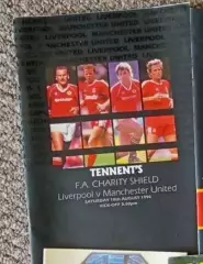 Ливерпуль - Манчестер Юнайтед 1990 Суперкубок Англии Финал