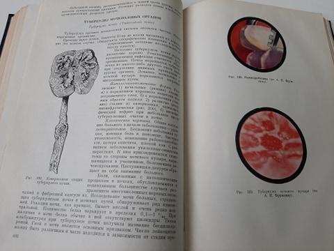 Книга Хирургические болезни (под ред. Смирнова) 1961 год 4